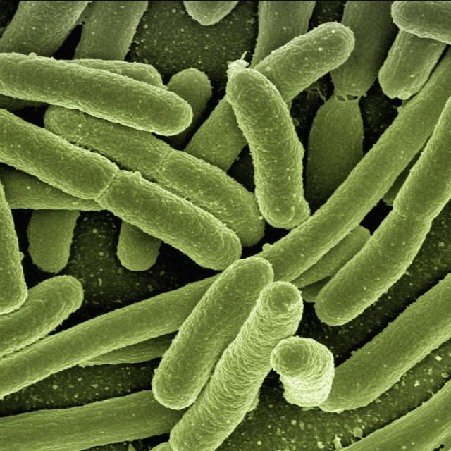Bakterie Escherichia coli | foto: Gerd Altmann,  Pixabay,  CC0 1.0