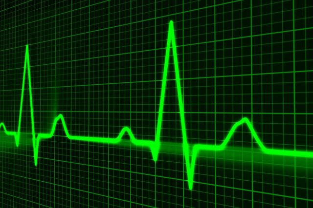 Defibrilátor umí vyslat k srdci elektrické impulzy,  které zastaví arytmii. Ilustrační foto | foto: CC0 Public domain
