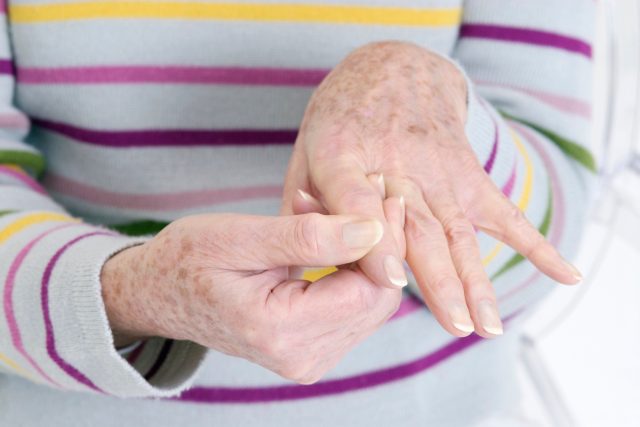 Revmatoidní artritidou trpí asi 100 tisíc obyvatel České republiky,  především ženy | foto: Fotobanka Profimedia