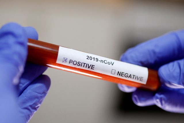 Test na koronavirus  (archivní foto) | foto: Dado Ruvic,  Reuters